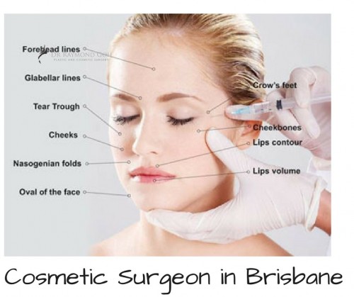 Facelift-Cosmetic-Surgery-in-Brisbane.jpg